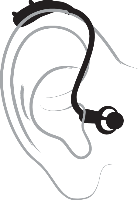 Technical illustration of an ear with a hearing aid device, focusing on the in-ear fitting.